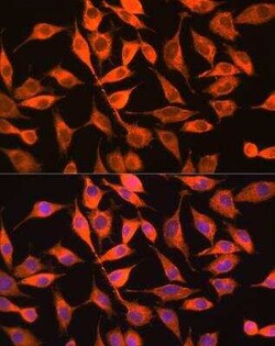 PITPN Antibody - Azide and BSA Free, Novus Biologicals 0.1 mL; Unconjugated:Antibodies,