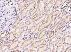 PITPNC1 Antibody, Novus Biologicals:Antibodies:Primary Antibodies