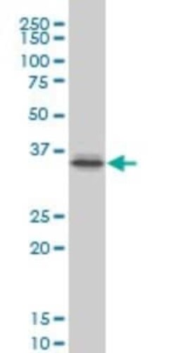 PITX1 Antibody (6D4), Novus Biologicals 0.1 mg | Buy Online | Novus Biologicals | Fisher Scientific