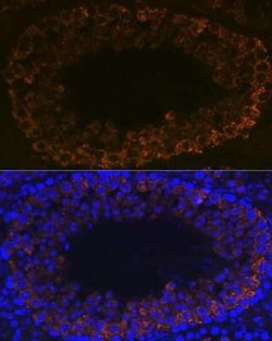 PIWIL1/HIWI Rabbit anti-Mouse, Rat, Clone: 0H5A4, Novus Biologicals:Antibodies:Primary