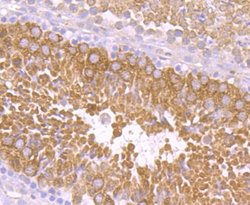 PIWIL1/HIWI Rabbit anti-Human, Mouse, Rat, Clone: JU35-12, Novus Biologicals