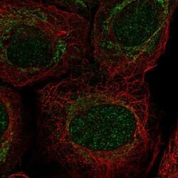 PIWIL4 Antibody, Novus Biologicals 25ul; Unconjugated:Antibodies, Polyclonal