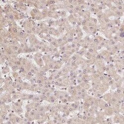 PIWIL4 Antibody, Novus Biologicals 0.1 mL | Buy Online | Novus Biologicals | Fisher Scientific