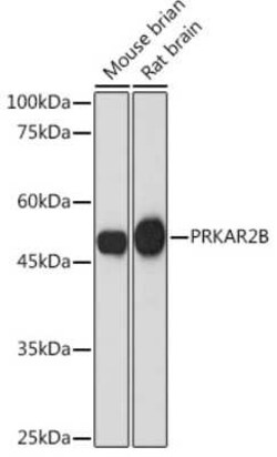 PKA 2 beta Rabbit anti-Human, Mouse, Rat, Clone: 2U2P1, Novus Biologicals 20 &mu;g | Buy Online | Novus Biologicals | Fisher Scientific