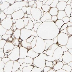 PKA 2 beta Antibody, Novus Biologicals 0.1 mL; Unconjugated:Anticorps,