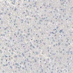 PKA 2 beta Antibody, Novus Biologicals 0.1 mL; Unconjugated:Anticorps,