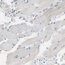 PKA 2 beta Antibody, Novus Biologicals 0.1 mL; Unconjugated:Anticorps,