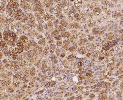PKA 2 beta Antibody, Novus Biologicals 50 &mu;g; Unconjugated:Antibodies,