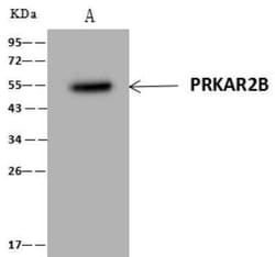PKA 2 beta Antibody, Novus Biologicals 50 &mu;g; Unconjugated:Antibodies,