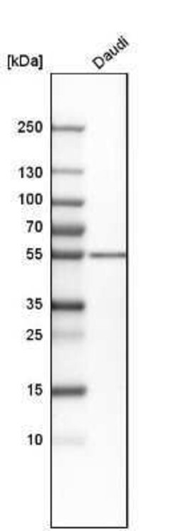 PKA 2 beta Antibody, Novus Biologicals 0.1 mL; Unconjugated:Anticorps,