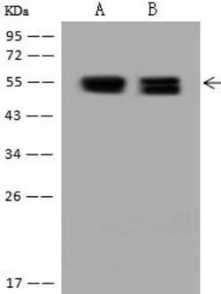 PKA 2 beta Antibody, Novus Biologicals 50 &mu;g; Unconjugated:Antibodies,