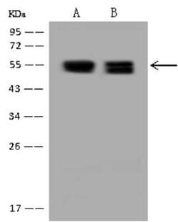 PKA 2 beta Antibody, Novus Biologicals 50 &mu;g; Unconjugated:Antibodies,