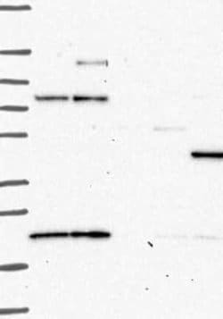 PKA 2 beta Rabbit anti-Human, Polyclonal, Novus Biologicals 25 &mu;g; Unconjugated:Antibodies,