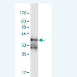 PKA R2 Antibody (3C7), Novus Biologicals 0.1 mg | Buy Online | Novus Biologicals | Fisher Scientific