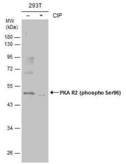 PKA R2, p Ser96 Antibody, Novus Biologicals 100 &mu;g | Buy Online | Bio-Techne | Fisher Scientific