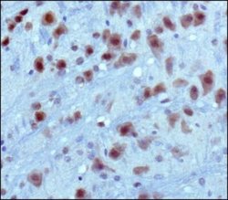 PKC alpha Antibody (MC5) - Azide and BSA Free, Novus Biologicals 0.1 mL;