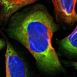 PKC alpha Antibody, Novus Biologicals 0.1 mL | Buy Online | Novus Biologicals | Fisher Scientific