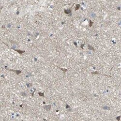 PKC alpha Antibody, Novus Biologicals 0.1 mL | Buy Online | Novus Biologicals | Fisher Scientific