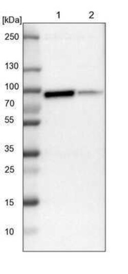 PKC alpha Antibody, Novus Biologicals 0.1 mL | Buy Online | Novus Biologicals | Fisher Scientific