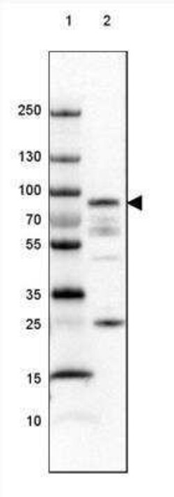 PKC alpha Antibody, Novus Biologicals 0.1 mL | Buy Online | Novus Biologicals | Fisher Scientific