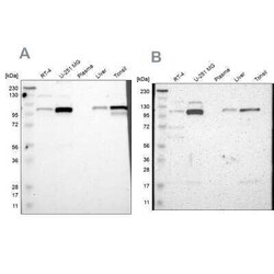 PKC alpha Antibody, Novus Biologicals 0.1 mL | Buy Online | Novus Biologicals | Fisher Scientific