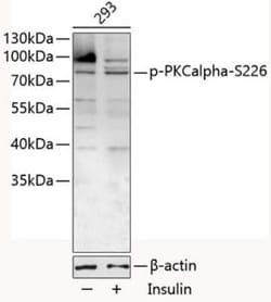 PKC alpha, p Ser226 Antibody - BSA Free, Novus Biologicals 100 &mu;g; Unconjugated:Antibodies,