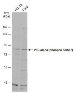 PKC alpha, p Ser657 Antibody, Novus Biologicals 100 &mu;g | Buy Online | Novus Biologicals | Fisher Scientific