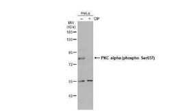 PKC alpha, p Ser657 Antibody, Novus Biologicals 100 &mu;g | Buy Online | Novus Biologicals | Fisher Scientific