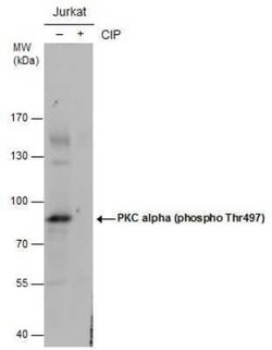 PKC alpha, p Thr497 Antibody, Novus Biologicals 100 &mu;g | Buy Online | Bio-Techne | Fisher Scientific