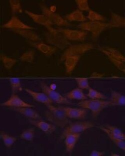 PKC delta Rabbit anti-Human, Mouse, Rat, Clone: 7I5U6, Novus Biologicals 100 &mu;g | Buy Online | Novus Biologicals | Fisher Scientific