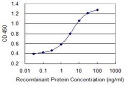 PKC delta Antibody (2G12), Novus Biologicals 0.1 mg; Unconjugated:Antikörper