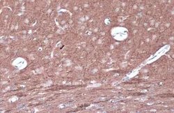PKC epsilon, p Ser729 Antibody, Novus Biologicals 100 &mu;g | Buy Online | Bio-Techne | Fisher Scientific