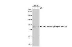 PKC epsilon, p Ser729 Antibody, Novus Biologicals 100 &mu;g | Buy Online | Bio-Techne | Fisher Scientific
