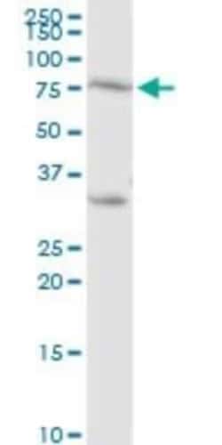 PKC eta Antibody, Novus Biologicals 0.1 mg | Buy Online | Novus Biologicals | Fisher Scientific