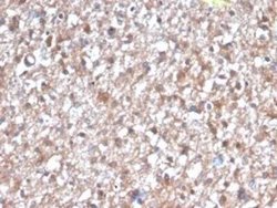 PKC iota Mouse anti-Human, Clone: PRKCI/4912, Novus Biologicals 20 &mu;g | Buy Online | Novus Biologicals | Fisher Scientific