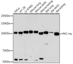 PKC mu Rabbit anti-Human, Mouse, Rat, Clone: 2A5U1, Novus Biologicals 20