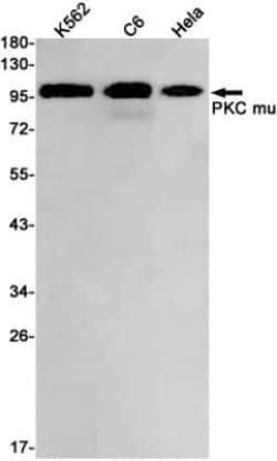 PKC mu Rabbit anti-Human, Mouse, Rat, Clone: S05-4J5, Novus Biologicals:Antibodies:Primary