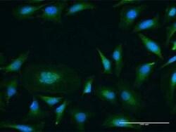 PKC mu Antibody, Novus Biologicals 0.05 mg | Buy Online | Novus Biologicals | Fisher Scientific