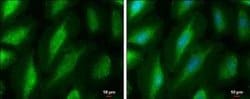 PKC mu Antibody, Novus Biologicals 100 &mu;g; Unconjugated:Antibodies,