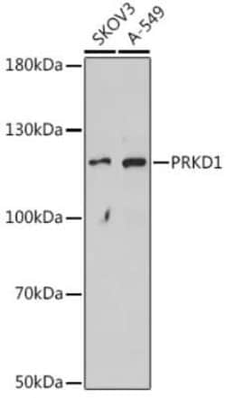 PKC mu Antibody - Azide and BSA Free, Novus Biologicals:Antibodies:Primary