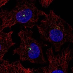 PKC theta Antibody, Novus Biologicals:Antibodies:Primary Antibodies