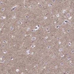 PKC zeta Antibody, Novus Biologicals:Antibodies:Primary Antibodies