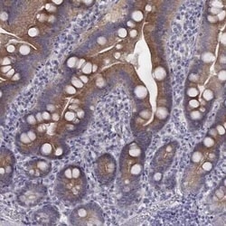 PKC zeta Antibody, Novus Biologicals:Antibodies:Primary Antibodies