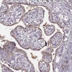 PKC zeta Antibody, Novus Biologicals:Antibodies:Primary Antibodies