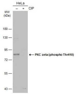 PKC zeta, p Thr410 Antibody, Novus Biologicals 100 &mu;g | Buy Online | Novus Biologicals | Fisher Scientific
