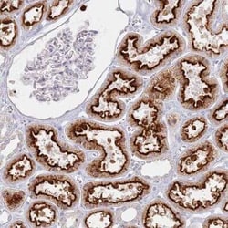 PKD2L2 Antibody, Novus Biologicals:Antibodies:Primary Antibodies