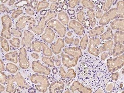 PKD2L2 Antibody, Novus Biologicals 50 &mu;g, Unconjugated:Antibodies, Polyclonal