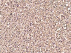 PKD2L2 Antibody, Novus Biologicals 50 &mu;g, Unconjugated:Antibodies, Polyclonal