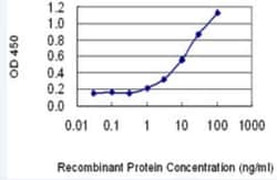 Novus Biologicals PKI-beta Antibody (7F8), Novus Biologicals 100 &mu;g | Buy Online | Novus Biologicals&trade; | Fisher Scientific