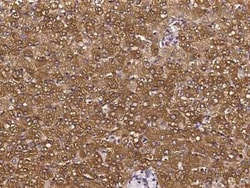 PKLR Antibody, Novus Biologicals:Antibodies:Primary Antibodies